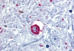 Invitrogen Bombesin Receptor 3 Polyclonal Antibody 50 &mu;g; Unconjugated:Antibodies,