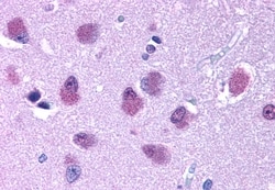Invitrogen Bombesin Receptor 3 Polyclonal Antibody 50 &mu;g; Unconjugated:Antibodies,
