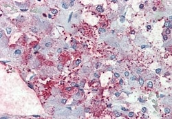 Invitrogen C8orf55 Polyclonal Antibody 50 &mu;g | Buy Online | Invitrogen&trade; | Fisher Scientific