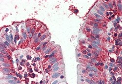 Invitrogen C8orf55 Polyclonal Antibody 50 &mu;g | Buy Online | Invitrogen&trade; | Fisher Scientific