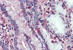 Invitrogen C8orf55 Polyclonal Antibody 50 &mu;g; Unconjugated:Antibodies,