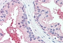 Invitrogen CADM2 Polyclonal Antibody 50 &mu;g | Buy Online | Invitrogen&trade; | Fisher Scientific