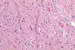 Invitrogen Caveolin 1 Polyclonal Antibody 50 &mu;g; Unconjugated:Antibodies,