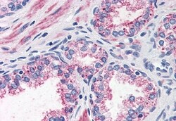 Invitrogen CCKAR Polyclonal Antibody 50 &mu;g; Unconjugated:Antibodies,