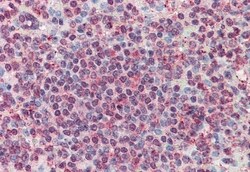 Invitrogen CD70 Polyclonal Antibody 50 μg; Unconjugated:Antibodies,