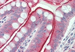 Invitrogen CDHR5 Polyclonal Antibody 50 &mu;g; Unconjugated:Antibodies,
