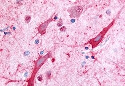 Invitrogen CERK Polyclonal Antibody 50 &mu;g; Unconjugated:Antibodies,