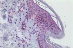 Invitrogen CHRM3 Polyclonal Antibody 50 &mu;g | Buy Online | Invitrogen&trade; | Fisher Scientific