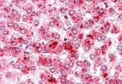 Invitrogen COMT Polyclonal Antibody 50 &mu;g | Buy Online | Invitrogen&trade; | Fisher Scientific