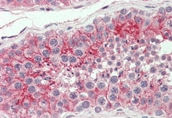 Invitrogen CAR Polyclonal Antibody 50 &mu;g; Unconjugated:Antibodies, Polyclonal