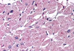 Invitrogen CYSLTR2 Polyclonal Antibody 50 &mu;g; Unconjugated:Antibodies,