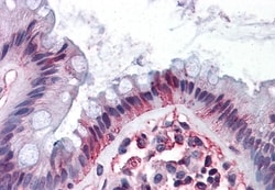 Invitrogen DPEP1 Polyclonal Antibody 50 &mu;g; Unconjugated:Antibodies,