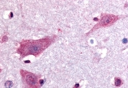 Invitrogen DPP10 Polyclonal Antibody 50 &mu;g; Unconjugated:Antibodies,