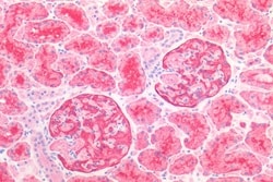 Invitrogen CD26 Polyclonal Antibody 50 &mu;g; Unconjugated:Antibodies,