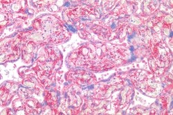 Invitrogen CD26 Polyclonal Antibody 50 &mu;g; Unconjugated:Antibodies,