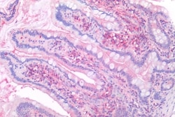 Invitrogen CD26 Polyclonal Antibody 50 &mu;g; Unconjugated:Antibodies,