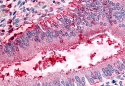 Invitrogen DPP8 Polyclonal Antibody 50 &mu;g; Unconjugated:Antibodies,