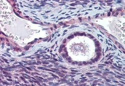 Invitrogen ELOVL5 Polyclonal Antibody 50 &mu;g; Unconjugated:Antibodies,