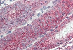 Invitrogen Embigin Polyclonal Antibody 50 &mu;g | Buy Online | Invitrogen&trade; | Fisher Scientific