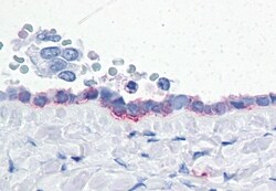 Invitrogen CD203c Polyclonal Antibody 50 &mu;g; Unconjugated:Antibodies,