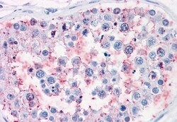 Invitrogen CD203c Polyclonal Antibody 50 &mu;g; Unconjugated:Antibodies,