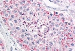 Invitrogen ERMP1 Polyclonal Antibody 50 &mu;g; Unconjugated:Antibodies,