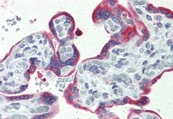 Invitrogen ERP44 Polyclonal Antibody 50 &mu;g; Unconjugated:Antibodies,