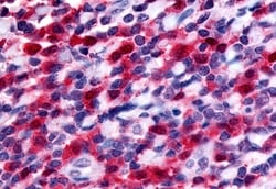 Invitrogen FLT3 Polyclonal Antibody 50 &mu;g; Unconjugated:Antibodies,