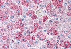 Invitrogen GCNT3 Polyclonal Antibody 50 &mu;g | Buy Online | Invitrogen&trade; | Fisher Scientific