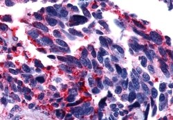 Invitrogen GPR101 Polyclonal Antibody 50 &mu;g; Unconjugated:Antibodies,