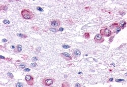 Invitrogen GPR101 Polyclonal Antibody 50 &mu;g; Unconjugated:Antibodies,