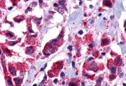 Invitrogen GPR101 Polyclonal Antibody 50 &mu;g; Unconjugated:Antibodies,