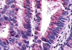 Invitrogen GPR101 Polyclonal Antibody 50 &mu;g; Unconjugated:Antibodies,