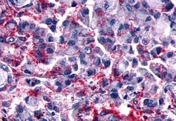 Invitrogen GPR101 Polyclonal Antibody 50 &mu;g; Unconjugated:Antibodies,