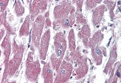Invitrogen GPR116 Polyclonal Antibody 50 μg; Unconjugated:Antibodies,