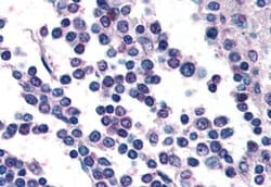 Invitrogen GPR132 Polyclonal Antibody 50 &mu;g | Buy Online | Invitrogen&trade; | Fisher Scientific