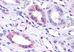 Invitrogen GPR146 Polyclonal Antibody 50 &mu;g | Buy Online | Invitrogen&trade; | Fisher Scientific