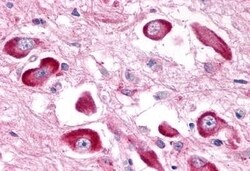 Invitrogen GPR146 Polyclonal Antibody 50 &mu;g | Buy Online | Invitrogen&trade; | Fisher Scientific