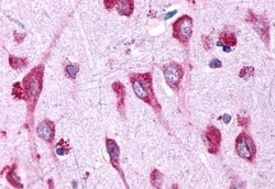 Invitrogen GPR146 Polyclonal Antibody 50 &mu;g | Buy Online | Invitrogen&trade; | Fisher Scientific