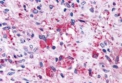 Invitrogen GPR146 Polyclonal Antibody 50 &mu;g | Buy Online | Invitrogen&trade; | Fisher Scientific