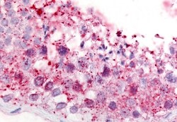 Invitrogen GPR18 Polyclonal Antibody 50 &mu;g; Unconjugated:Antibodies,