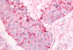 Invitrogen GPR182 Polyclonal Antibody 50 &mu;g | Buy Online | Invitrogen&trade; | Fisher Scientific