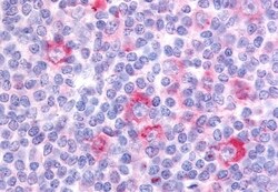 Invitrogen GPR62 Polyclonal Antibody 50 &mu;g; Unconjugated:Antibodies,