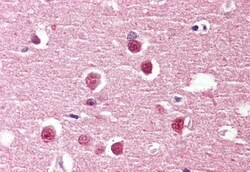 Invitrogen GPR98 Polyclonal Antibody 50 μg; Unconjugated:Antibodies,