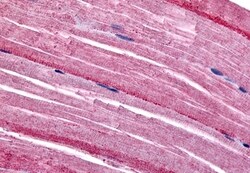Invitrogen GRK5 Polyclonal Antibody 50 &mu;g; Unconjugated:Antibodies,