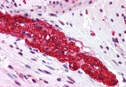 Invitrogen mGluR5 Polyclonal Antibody 50 &mu;g; Unconjugated:Antibodies,