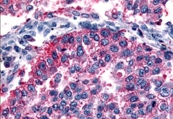 Invitrogen mGluR6 Polyclonal Antibody 50 &mu;g; Unconjugated:Antibodies,