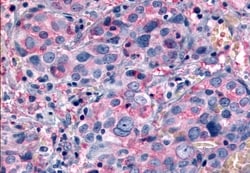 Invitrogen mGluR6 Polyclonal Antibody 50 &mu;g; Unconjugated:Antibodies,