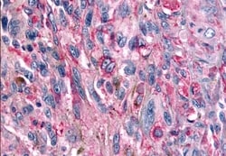 Invitrogen mGluR6 Polyclonal Antibody 50 &mu;g; Unconjugated:Antibodies,