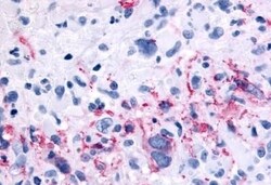 Invitrogen mGluR6 Polyclonal Antibody 50 &mu;g; Unconjugated:Antibodies,